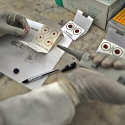 Новини України - На Сумщині від тропічної малярії помер чоловік