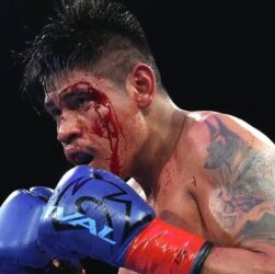 Новини спорту - Наваррет пролив світло на суперечливий момент зупинки його бою з Суаресом