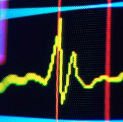 Технології - Ритм у пульсі людини може сигналізувати про майбутнє когнітивне погіршення