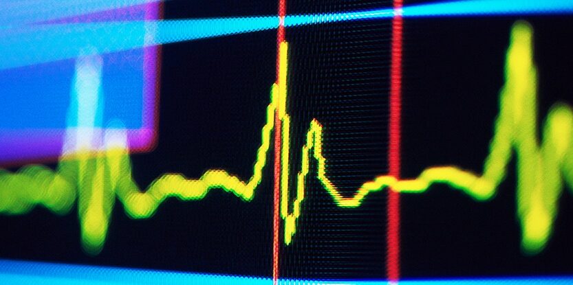 Технології - Ритм у пульсі людини може сигналізувати про майбутнє когнітивне погіршення