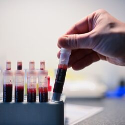 Новини України - Відомо, скільки випадків ВІЛ-інфекції зафіксували в Україні з початку року