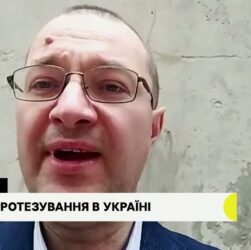 Біонічне протезування. Гостьова студія з Віталієм Музиченко, гендиректором Фонду.