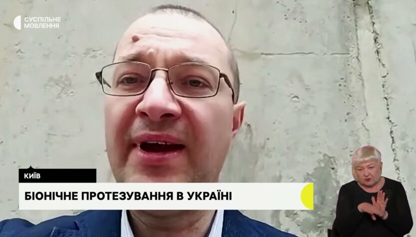 Біонічне протезування. Гостьова студія з Віталієм Музиченко, гендиректором Фонду.