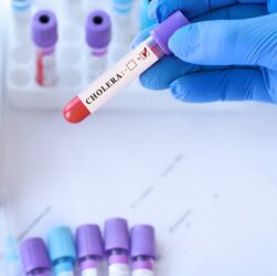 Новини світу - У Польщі перший випадок холери за шість років