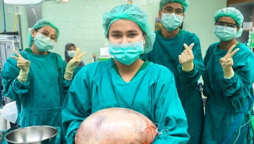 Новини світу - В Таїланді лікарі видалили 8-кілограмову кісту