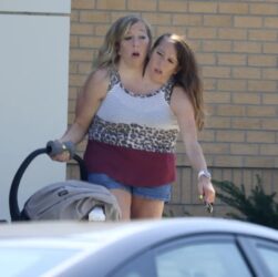 Новини світу - Сіамські близнючки Еббі та Бріттані вперше стали мамами - ЗМІ