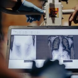 Новини України - У ЗСУ цифровізують медицину - Сирський