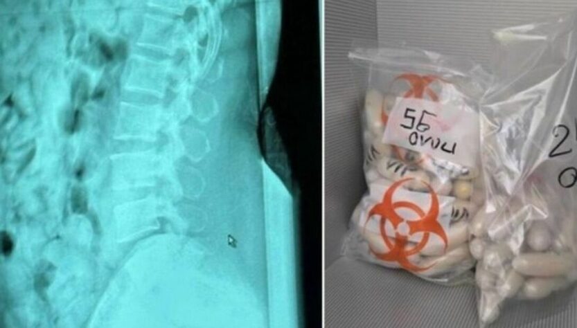 Новини світу - В Італії затримано жінку з 1,4 кг героїну в шлунку