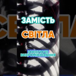 Чому рентген показує кістки? 🦴 #наука #цікаво #рентген #медицина