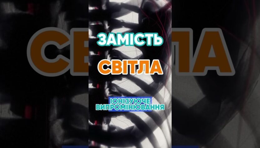 Чому рентген показує кістки? 🦴 #наука #цікаво #рентген #медицина