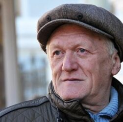 Новини культури - Відомий продюсер розповів про невдалі косметологічні процедури