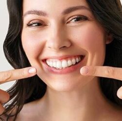 Без категорії - Як відбілити зуби в домашніх умовах