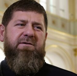 Новини світу - У Кадирова відмовили нирки, йому шукають заміну - ЗМІ